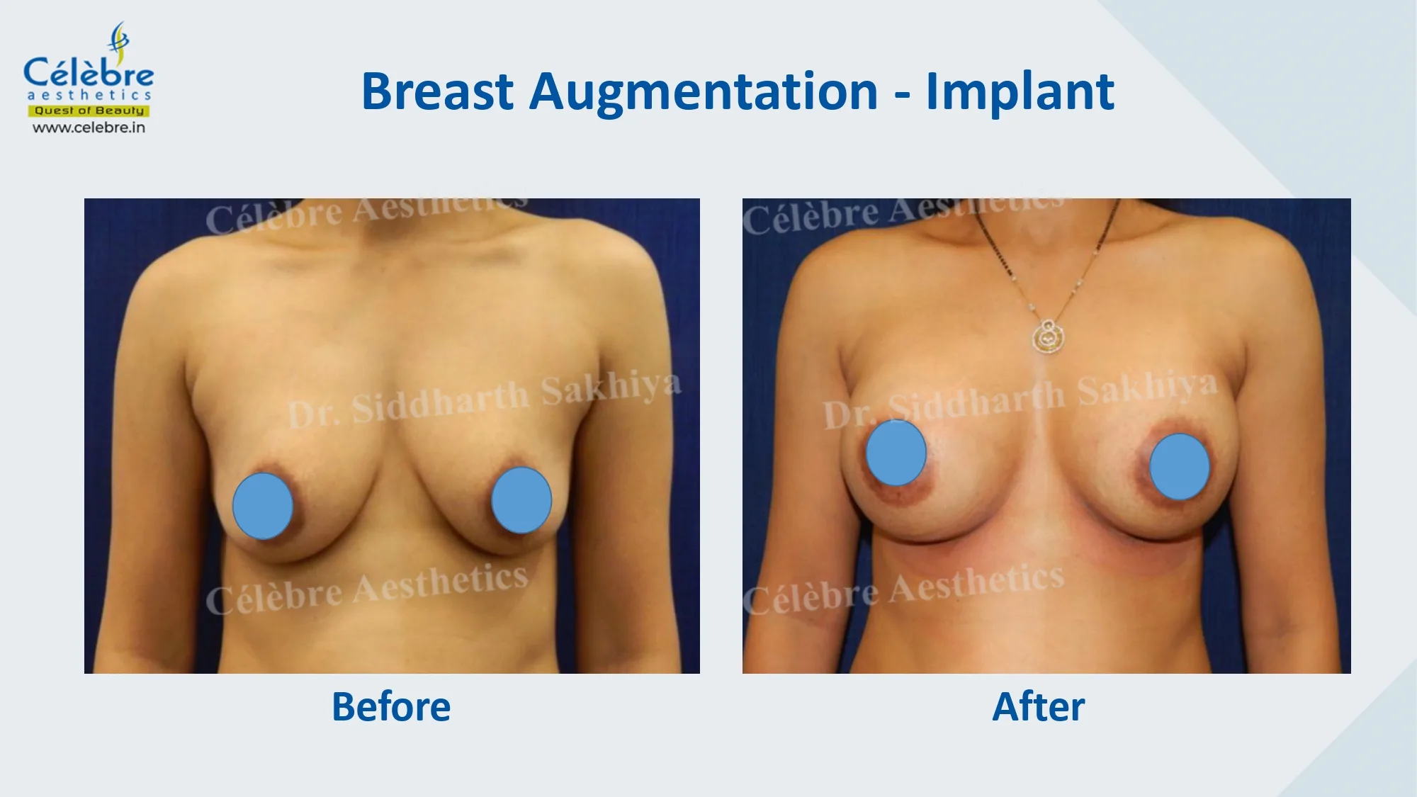 PPT (1)_page-0032