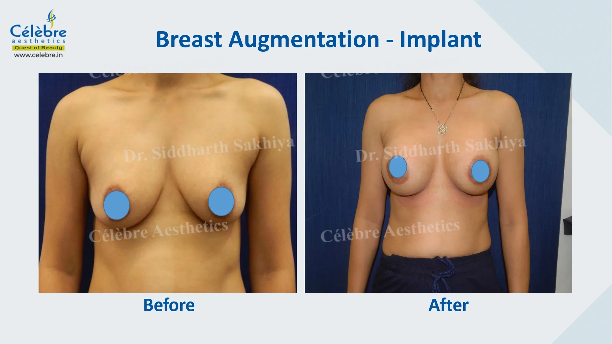 PPT (1)_page-0033