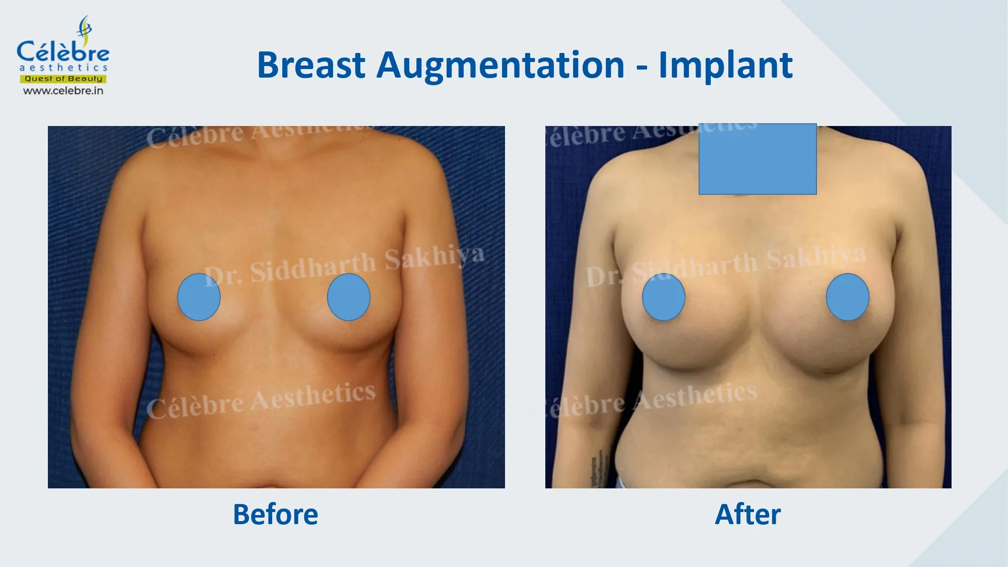 PPT (1)_page-0034