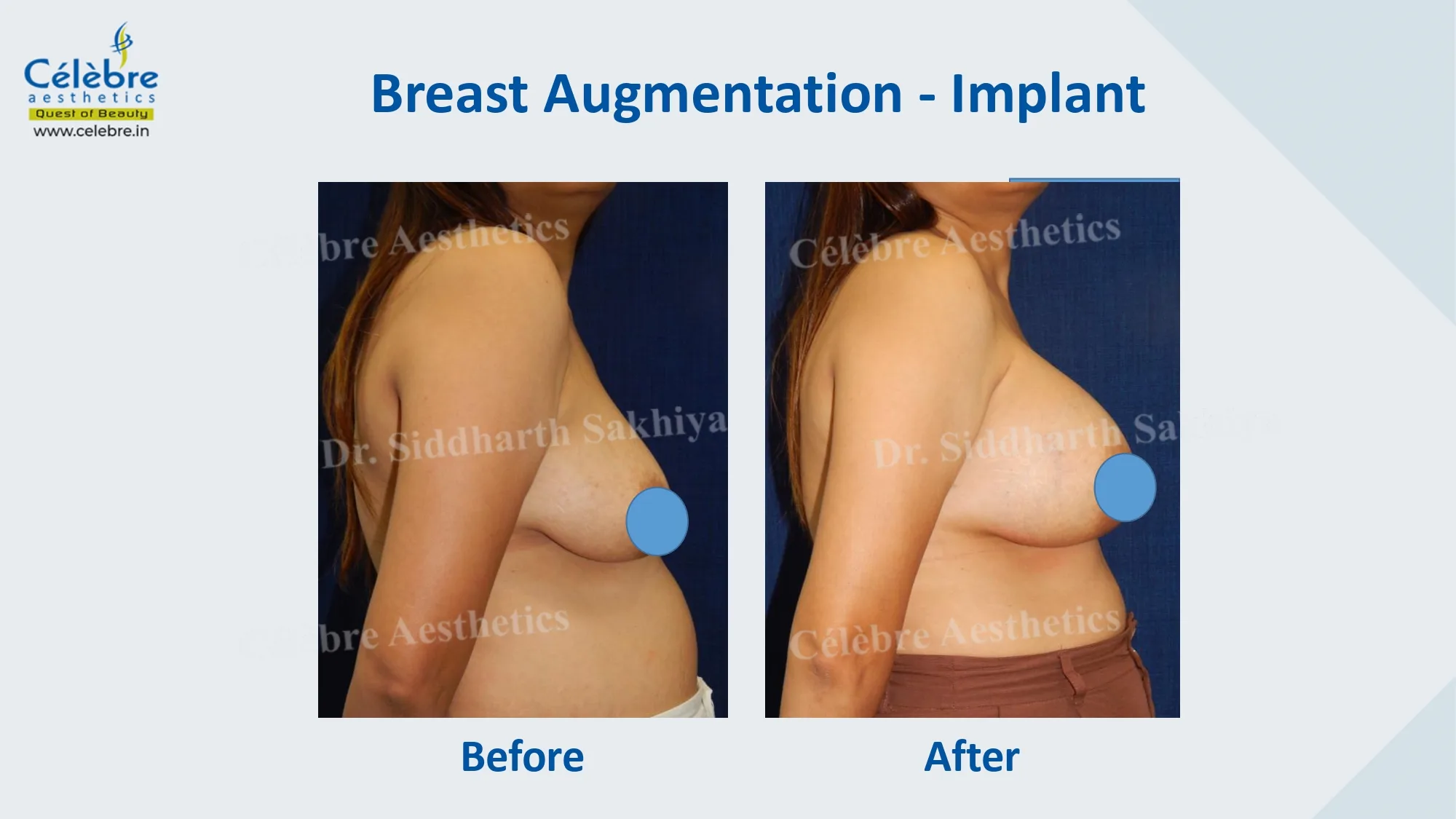 PPT (1)_page-0035