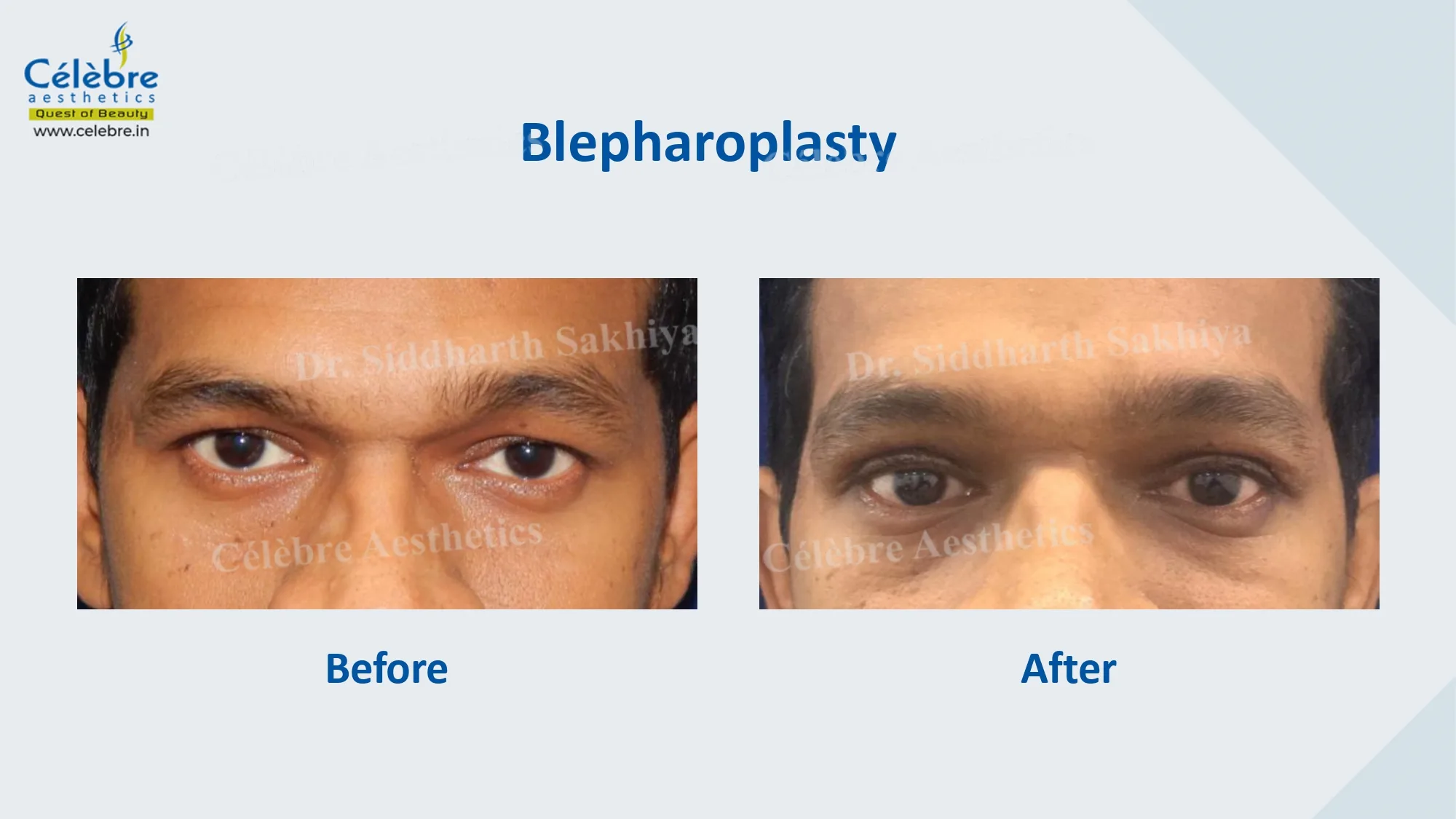 PPT (1)_page-0052