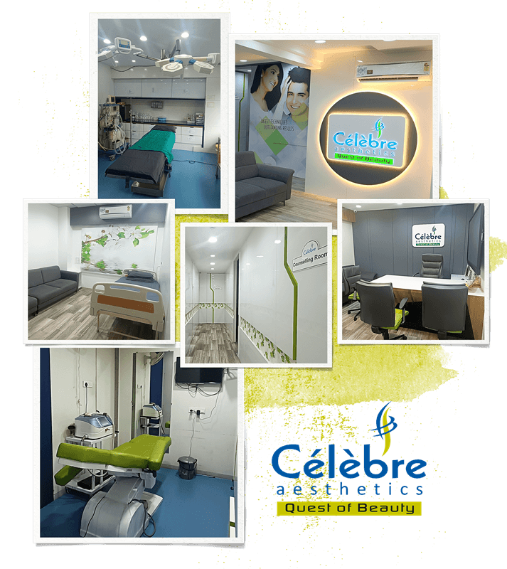 best-cosmetic-clinic-in-ahmedabad-surat-rajkot