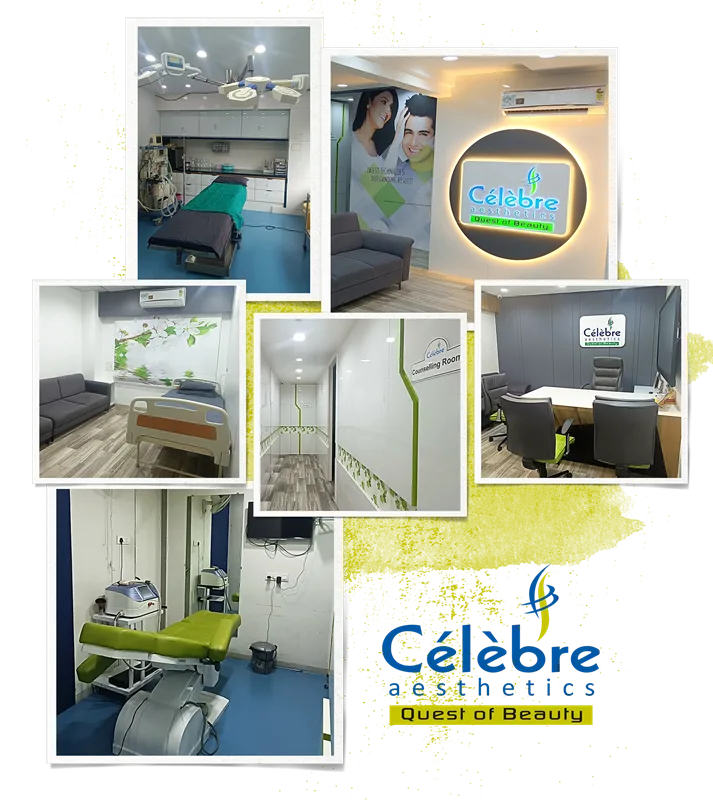 best-cosmetic-clinic-in-ahmedabad-surat-rajkot