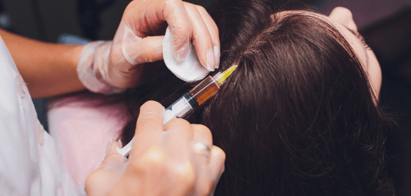 Medical hair growth trratments