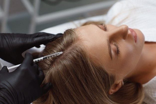 microneedling for hair growth tretments