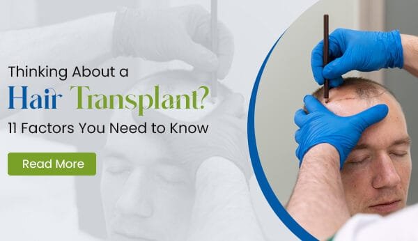 11 factors about hair transplant