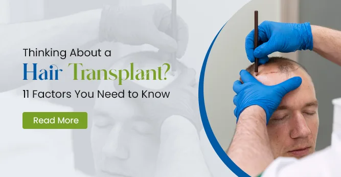 11 factors about hair transplant