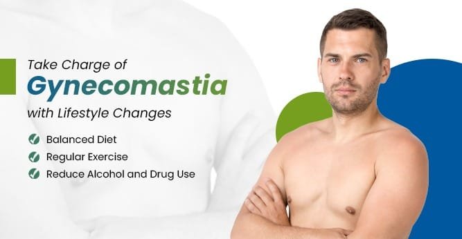 Tips to Manage Gynecomastia