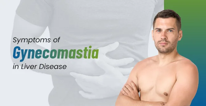 Symptoms of Gynecomastia in Liver Disease