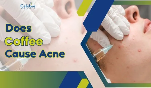does coffee cause acne