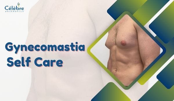 gynecomastia-self-care