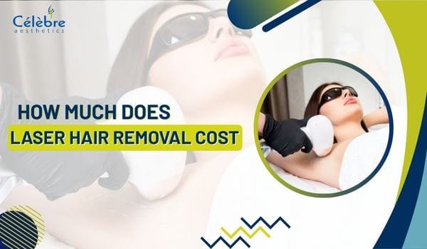 how much does laser hair removal cost