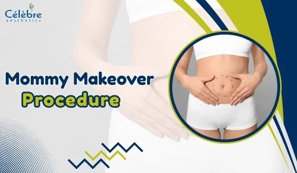 Mommy Makeover