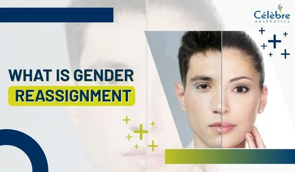 Gender Reassignment Surgery
