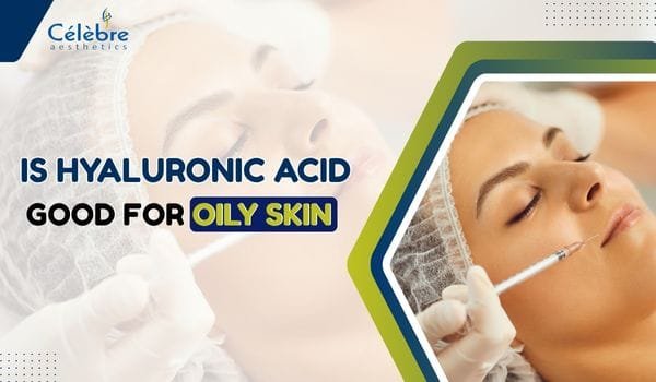 Is Hyaluronic Acid Good for Oily Skin