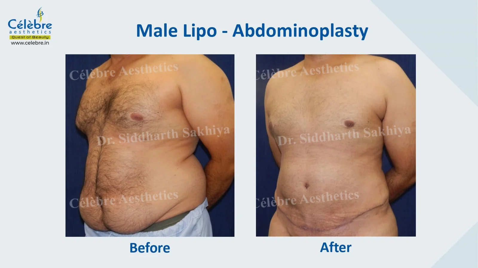PPT-1_page-0020