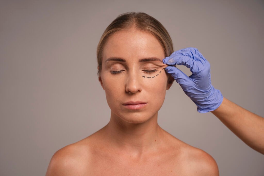 coronal bro lift
