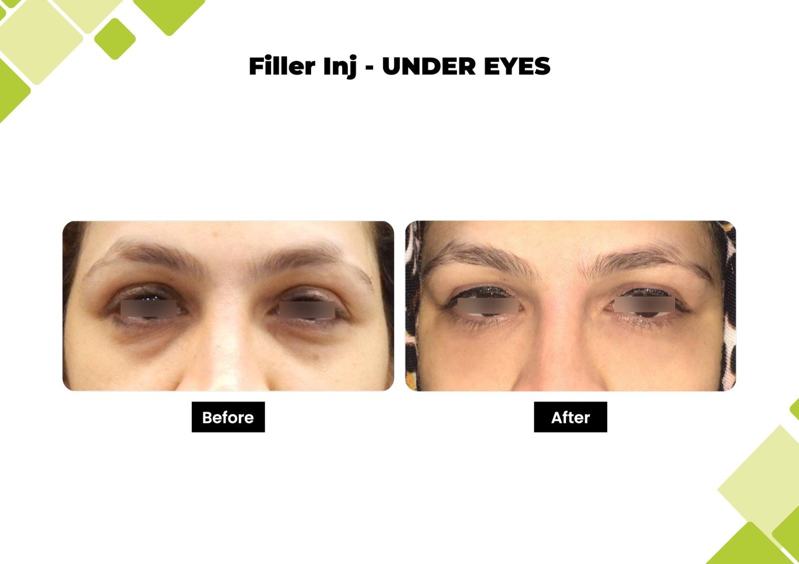 filler11